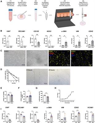 Human and porcine aortic valve endothelial and interstitial cell isolation and characterization